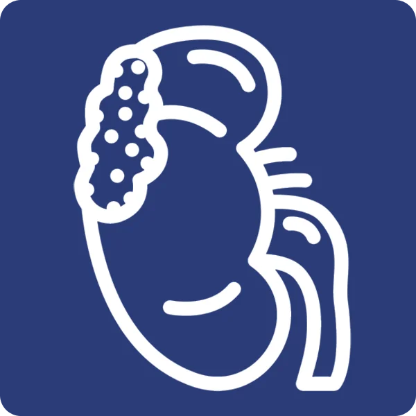 Kidney Cancer