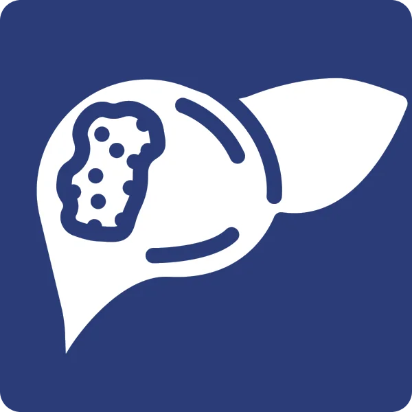 Liver Cancer